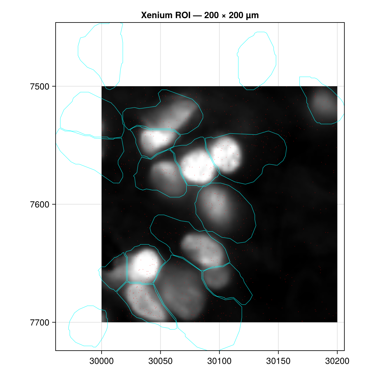 Xenium ROI — tissue image, cell boundaries, transcripts